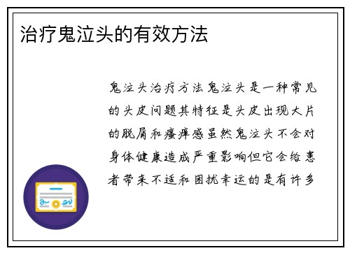 治疗鬼泣头的有效方法